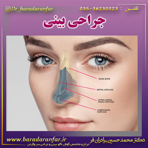جراحی زیبایی بینی