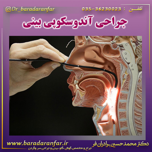 جراحی آندوسکوپی بینی