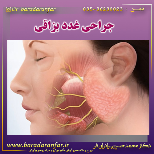 جراحی غدد بزاقی