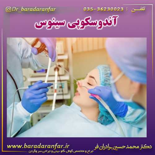 آندوسکوپی سینوس