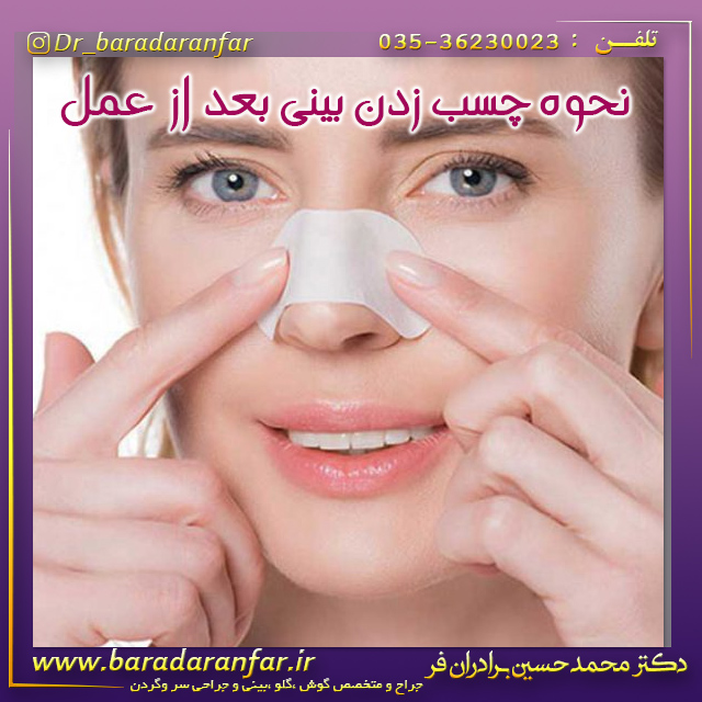 نحوه چسب زدن بینی بعد از عمل